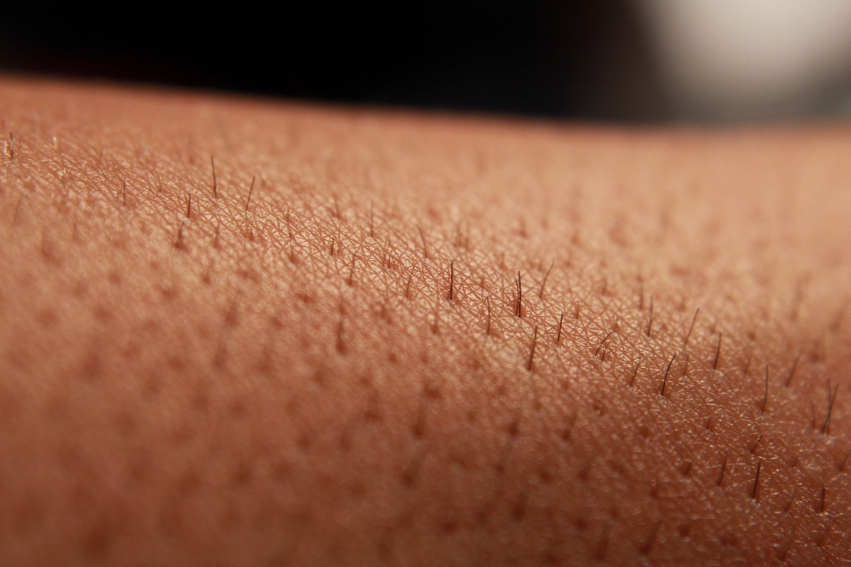 EPILATION REPOUSSE